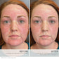 HydroPure™ Colour Correcting Serum with Hyaluronic Acid & CoQ10